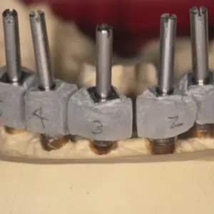 Restorative Implant Online Master Class | Perri