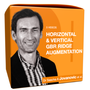 EDIBLE Horizontal & Vertical GBR Ridge Augmentation in 5 Videos | Jovanovic & Simion